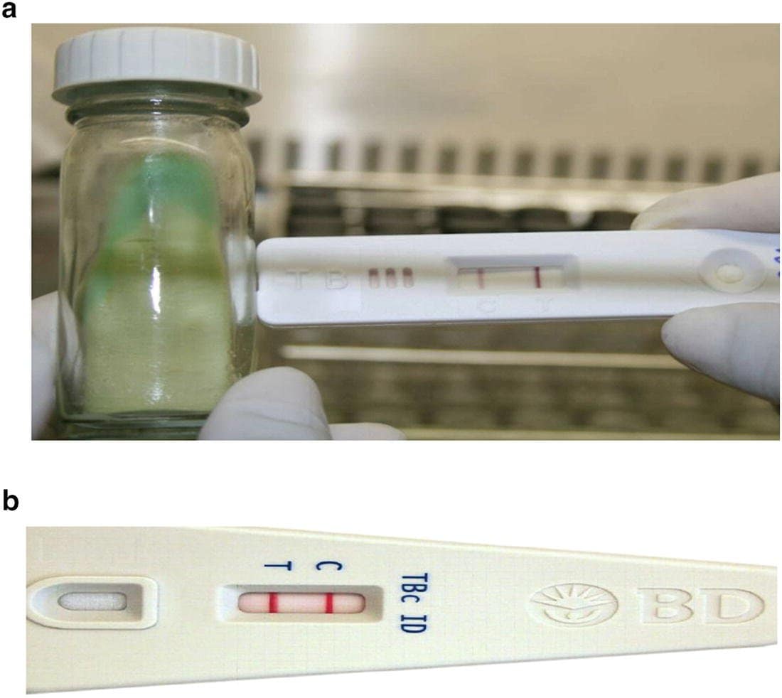 470991_1_En_23_Fig4_HTML